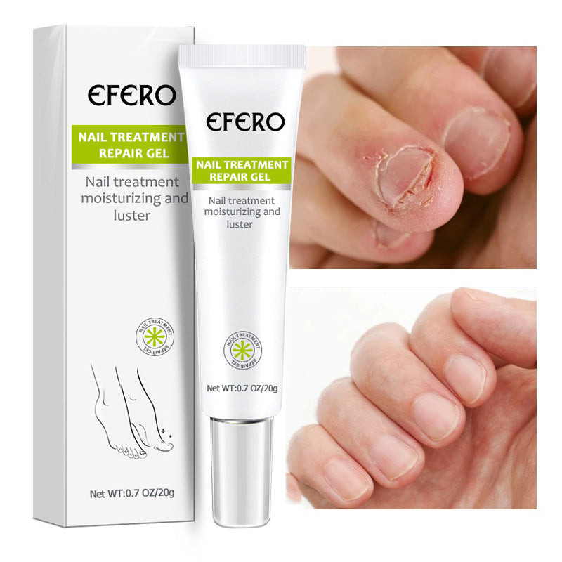 EFERO Nail Treatment Repair Cream Toe Be Health Instant Beauty Gel Cure Damaged Foot & Toenails Restores Appearance of Discolored or Damaged Nails