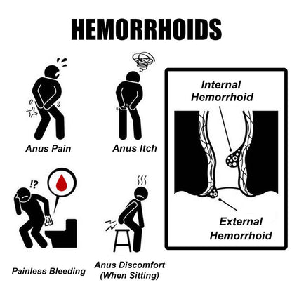 New Herbal Hemorrhoid Ointment Treatment Internal External Anal Fissure & Anal Swell Bleed Counterpain Cream Hemorrhoids Ointment Herbal Internal And External Piles Pain Relief Cream