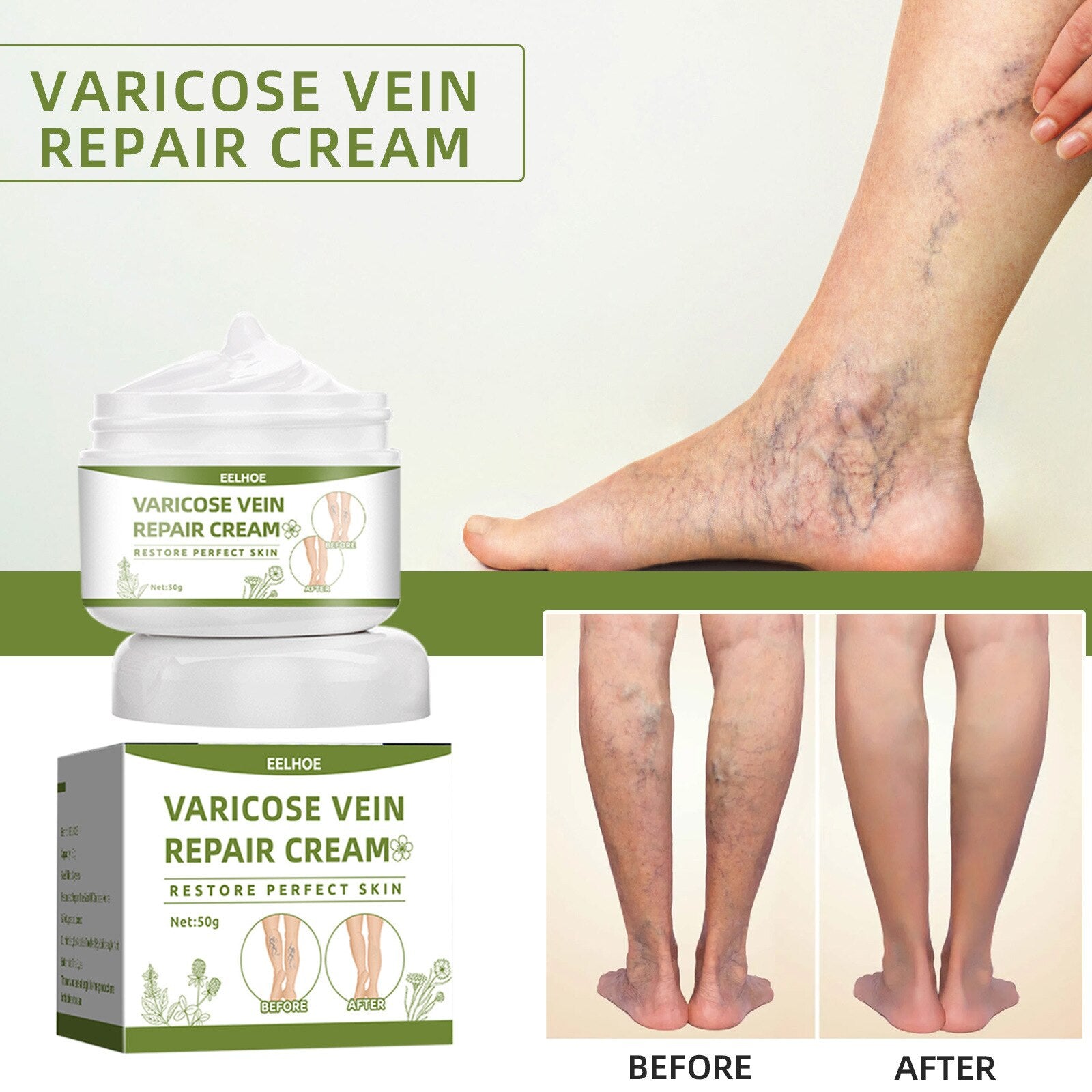 Varicose Veins Repair Cream Spider Varicose Vein Treatment Cream Vein Healing Ointment Improving Blood Circulation Leg Repair Gel