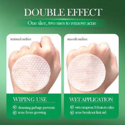 Salicylic Acid Acne Treatment Pads and Face Mask