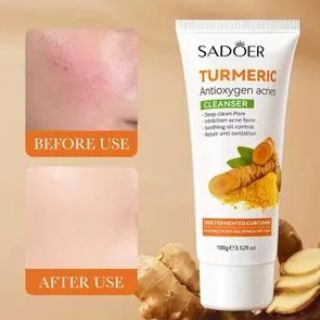 SADOER Turmeric Antioxygen Acnes Cleanser Anti Acnes Soothing Oil Control Dark Circles & Repair -100g