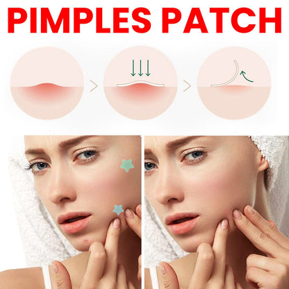 200pcs Repair Acne Patch Facial Skin Care Fade Blemishes Pimple Marks Closed Acne Blemishes Cover Acne Pimple Repair Patch