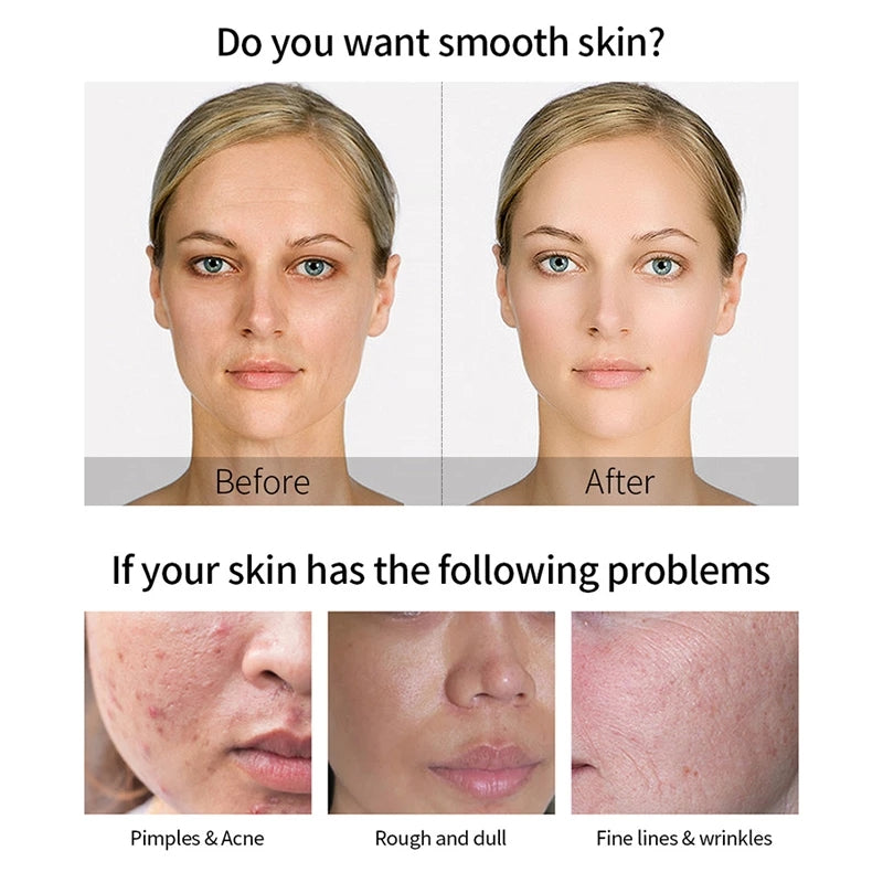 [Promotion] 100ml 24k Gold Hyaluronic Acid Nicotinamide Face Serum Anti Aging Facial Lifting Collagen Essence Skin Care Whitening Serum