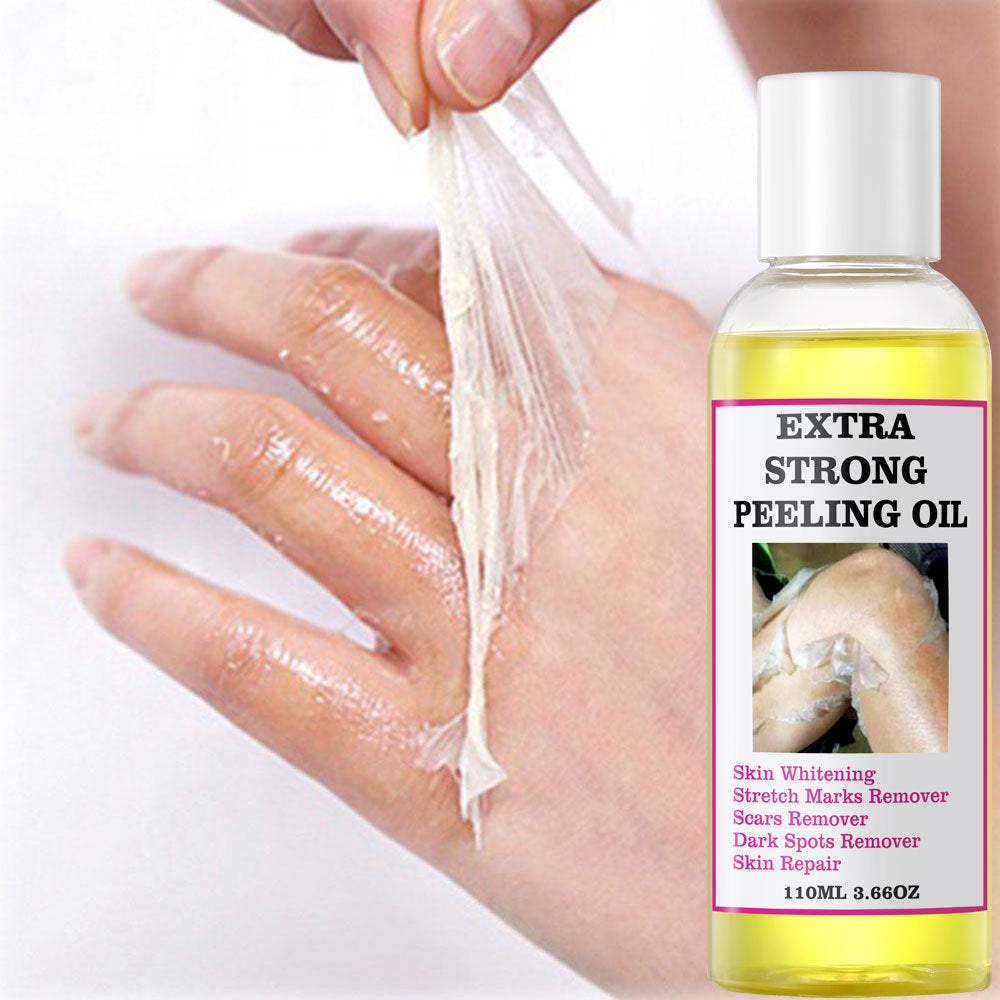 Extra Strong Yellow Peeling Oil Whitening Peeling Oil Skin Care Lighten Elbows Knees Hands Melanin Even Skin Tone and Whiten Skin