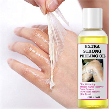 Extra Strong Yellow Peeling Oil Whitening Peeling Oil Skin Care Lighten Elbows Knees Hands Melanin Even Skin Tone and Whiten Skin
