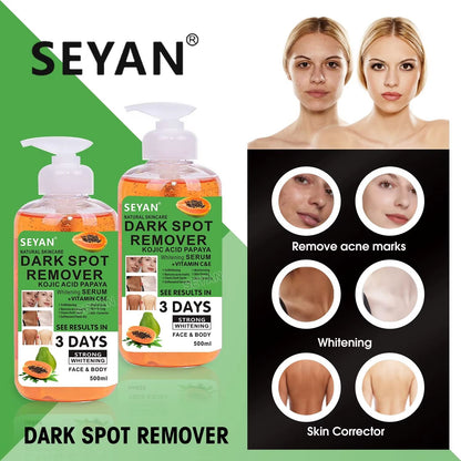 Seyan Dark Spot Remover 500ml – Powerful Skin Lightening & Brightening Cream for Face & Body – Fades Dark Spots, Acne Marks, Hyperpigmentation & Uneven Skin Tone for Radiant, Smooth Skin