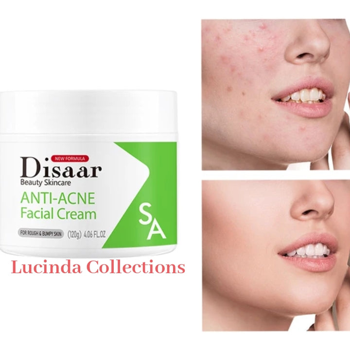 Salicylic Acid Anti-acne Facial Cream Ceramide Whitening Repair Fade Acne marks Anti-inflammatory Moisturizing SA - Disaar