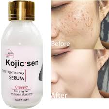 Kojie San Kojic Acid Whitening Serum With Vitamin C - 125ml