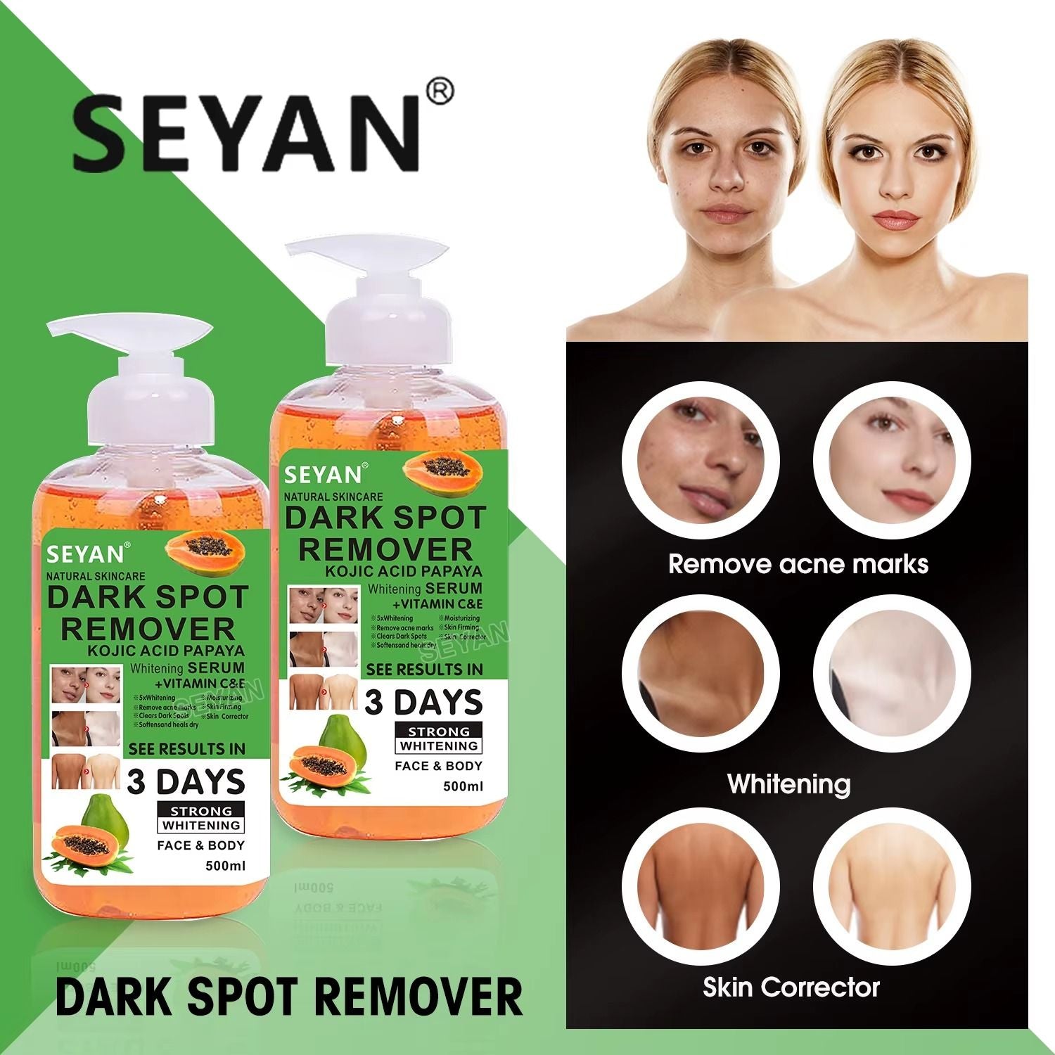 Seyan Dark Spot Remover 500ml – Powerful Skin Lightening & Brightening Cream for Face & Body – Fades Dark Spots, Acne Marks, Hyperpigmentation & Uneven Skin Tone for Radiant, Smooth Skin