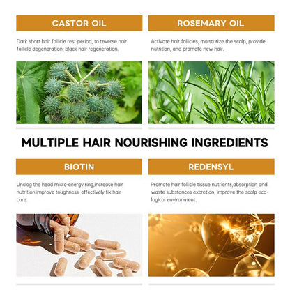 Castor oil Biotin Hair Growth Solution Hair Growth Rosemary Hair Essence Hair Care Loss Products