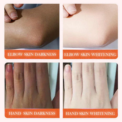 SADOER Dark Knuckles Whitening Brightening Serum Elbows,Knees, Fingers Hand Whitener Fingers Brighten Moisturize Black Dark Skin Spot Lighten Stains Remover Essence Products