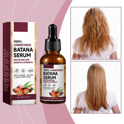 EELHOE Batana Oil Hair Care Essential Oil Hair Strengthening Hair Growth Serum Anti-Hair Loss Treatment Repairs Frizzy Hair Deep Nourishes Scalp Smooth Hair Conditioner Ehance Hair Shine Batana Serum
