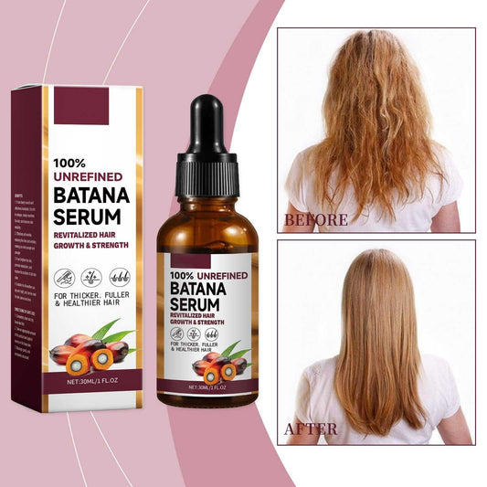 EELHOE Batana Oil Hair Care Essential Oil Hair Strengthening Hair Growth Serum Anti-Hair Loss Treatment Repairs Frizzy Hair Deep Nourishes Scalp Smooth Hair Conditioner Ehance Hair Shine Batana Serum