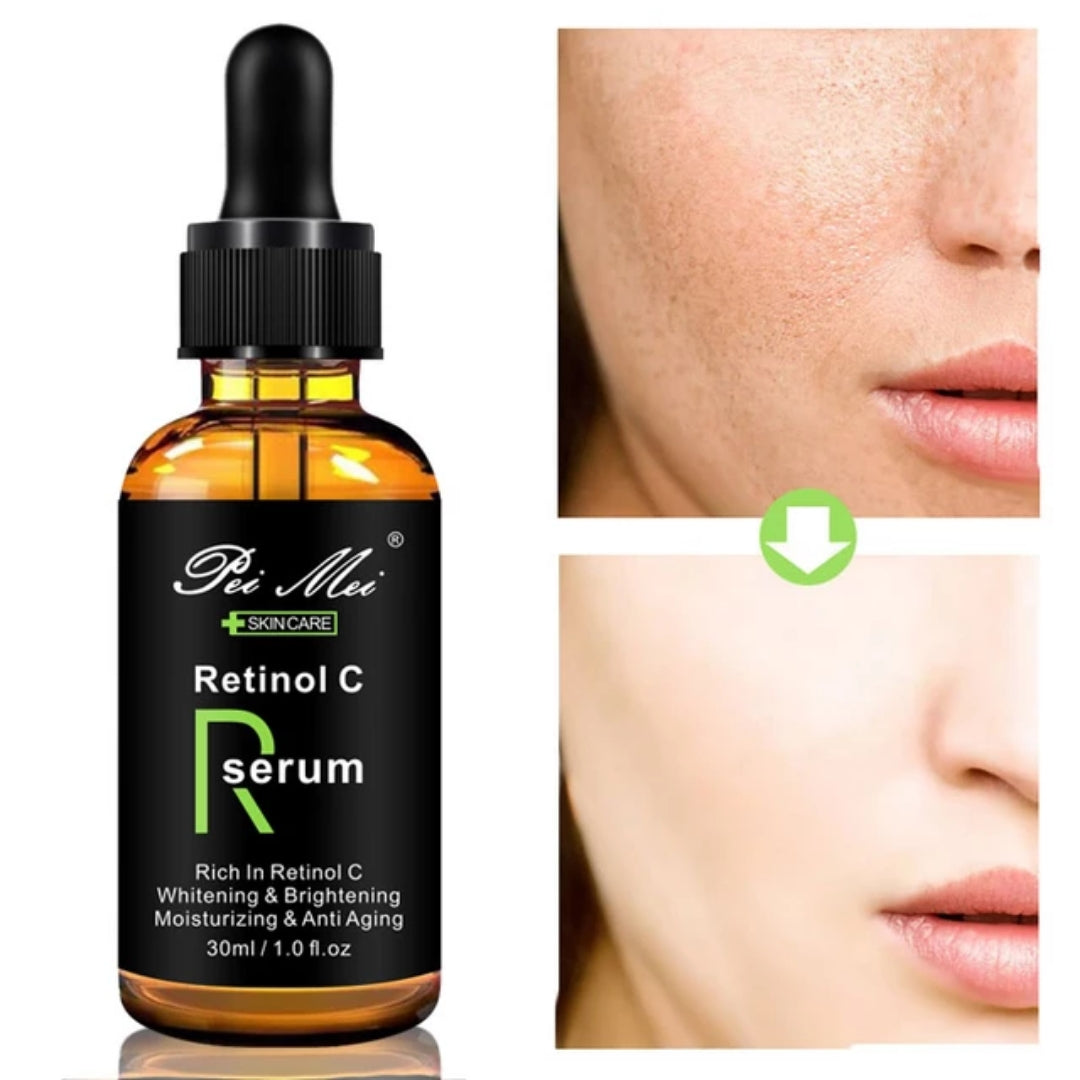 Pei Mei Retinol C Serum - Brightening Whitening, Remove Spots, Moisturizing Face Skin Care, 30ml