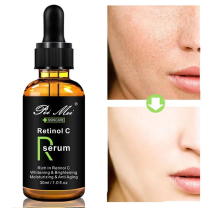 Pei Mei Retinol C Serum - Brightening Whitening, Remove Spots, Moisturizing Face Skin Care, 30ml
