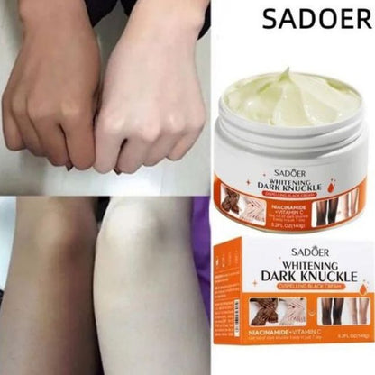 Sadoer Dark Knuckle Whitening Cream Skin Body Bleaching For Dark Knees and Elbows,Moisturizing Strong Joint Whitening Cream for Clavicle,Neck,Niacinamide Vitamin C Dark Spot Corrector Remover