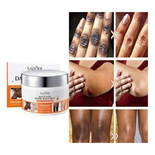 Whitening Dark Knuckle Cream with Niacinamide and Vitamin C For Removing dark knuckles, whitening joints-140g