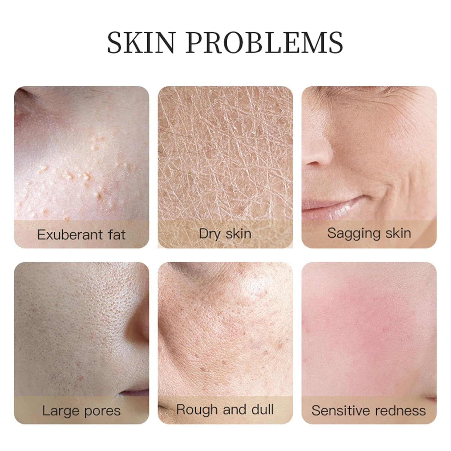 6pcs KORMESIC Elite 24K Gold Luxury Skincare Set: 6-Piece Anti-Aging Regimen with Gold Foil Serum & Cream - Firming, Lifting & Rejuvenating Collection for Tight, Smooth Skin