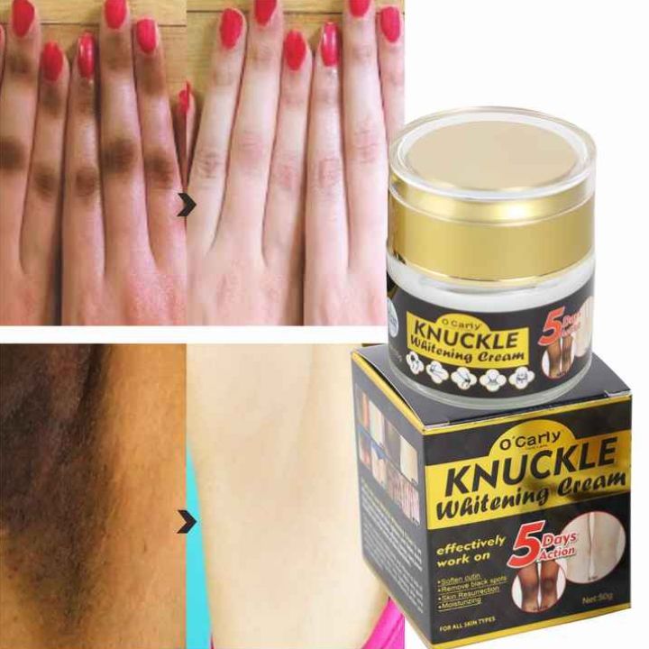O'Carly Knuckle Whitening Cream. Clears Dark Knuckles Spots Ocarly