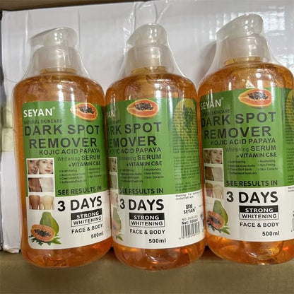 Seyan Dark Spot Remover 500ml – Powerful Skin Lightening & Brightening Cream for Face & Body – Fades Dark Spots, Acne Marks, Hyperpigmentation & Uneven Skin Tone for Radiant, Smooth Skin