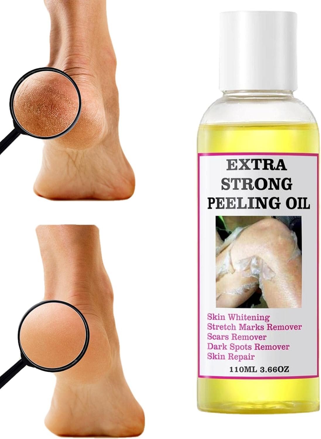 2 Packs Dr Davey Skin Peeling Oil | Safe Yellow Peeling Oil Extra Strength,Strong Peeling Oil for Skin Brightening Moisturizing, Removes Dead Skin Cells 118ml X 2