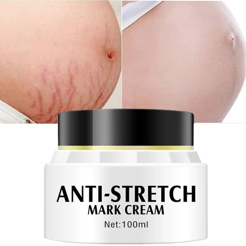 Removes Stretch Mark Cream Postpartum Pregnancy Scars Repair Creams Anti-Aging Anti-Wrinkles Maternity Skin Repair Treatment Body Moisturizing Brighten Skin Care Cream