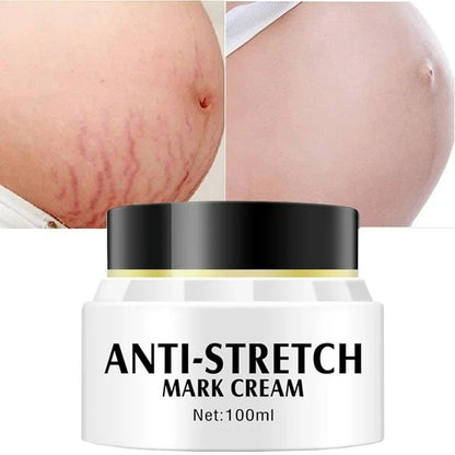 Removes Stretch Mark Cream Postpartum Pregnancy Scars Repair Creams Anti-Aging Anti-Wrinkles Maternity Skin Repair Treatment Body Moisturizing Brighten Skin Care Cream