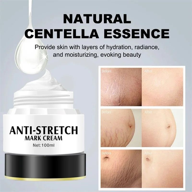 Removes Stretch Mark Cream Postpartum Pregnancy Scars Repair Creams Anti-Aging Anti-Wrinkles Maternity Skin Repair Treatment Body Moisturizing Brighten Skin Care Cream