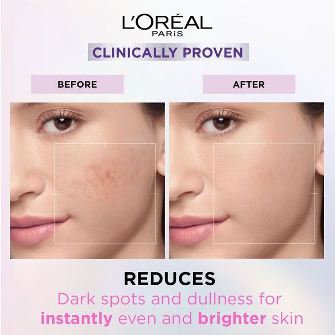 【Discounted】L'Oreal Paris GLYCOLIC BRIGHT SERUM 15ML