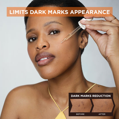 【Discounted】Garnier Brightening Night Serum With 10% Pure Vitamin C 30Ml