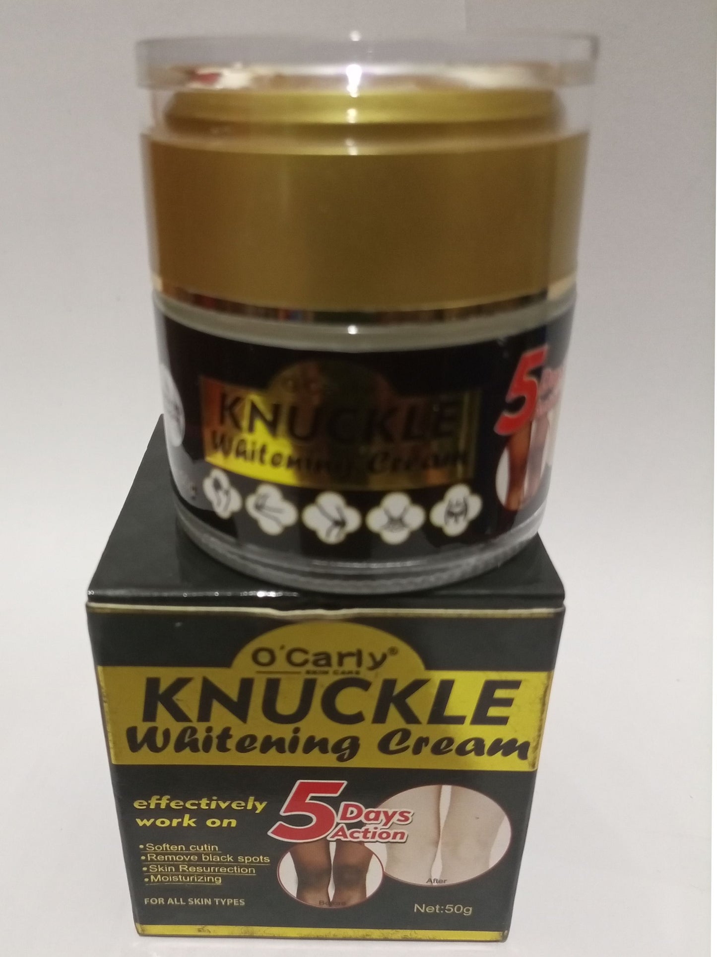 O'Carly Knuckle Whitening Cream. Clears Dark Knuckles Spots Ocarly