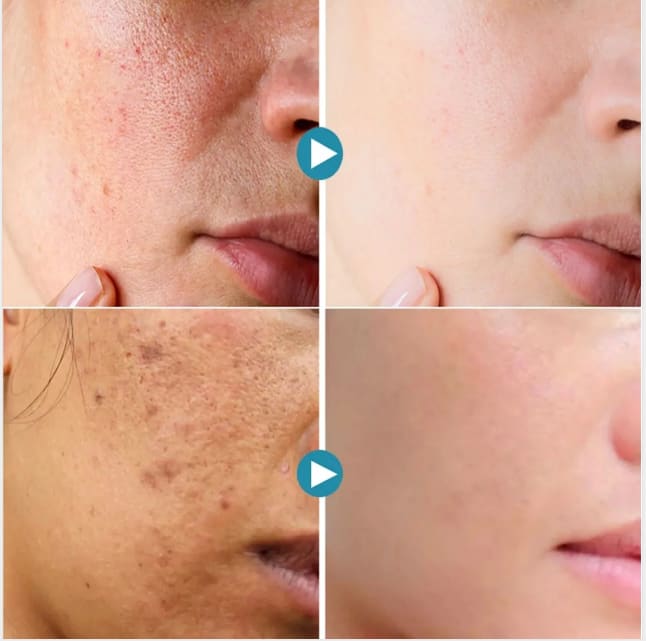 Lactobionic Acid Shrink Pores Serum Korean Cosmetics Fade Fine Lines Anti-Aging Face Care Whiten Moisturizing Skin Care