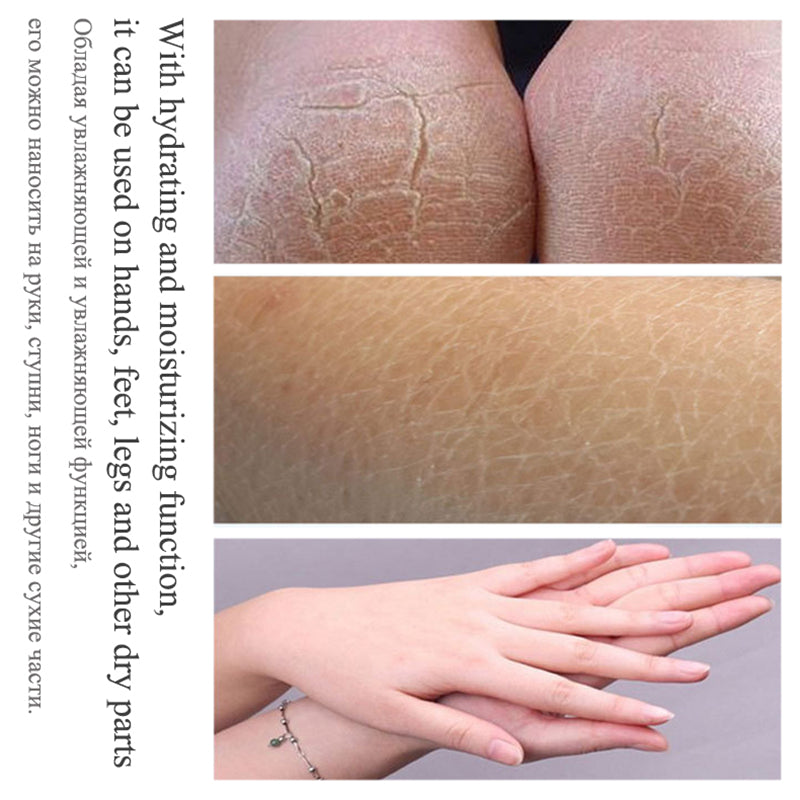 85g Anti Crack Foot Cream Dryness Foot Mask Heel Cracked Repair Cream Hand Mositurizing Removal Callus Dead Skin Hands Feet Care 4.5