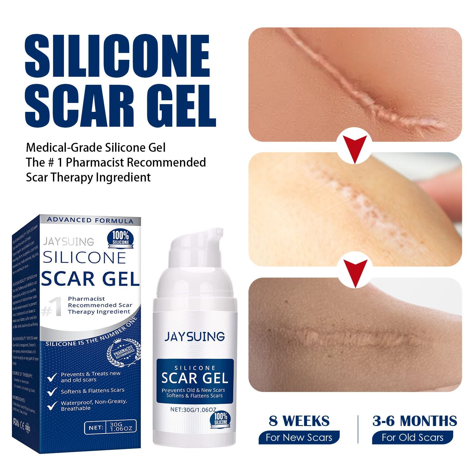 Silicone Scar Removal Gel Removal Skin Scars Cream Treat Surgery Scars Stretch Marks Acne Pox Prints Burn Repair Facial Care Gel Whitening Pigmentation Corrector