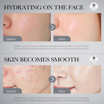 7pcs BIOAQUA Deep Mineral Dead Sea Facial Mask Sheet Moisture Mud Mask Face Care Skin Care Set Acne Sunscreen Pores Moisturizing Oil-control Anti-aging Replenishment Facia Product