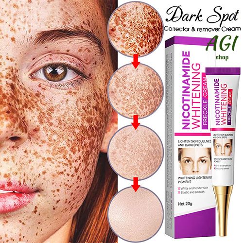 Face Skin Care Set Nicotinamide Whitening Freckles Cream + Facial Cleanser + Moisturizing lotion + Face Essence + Face Toner + Masks 5 Pcs Remove Melasma Dark Spot Acne Marks Brightening Skin Tone